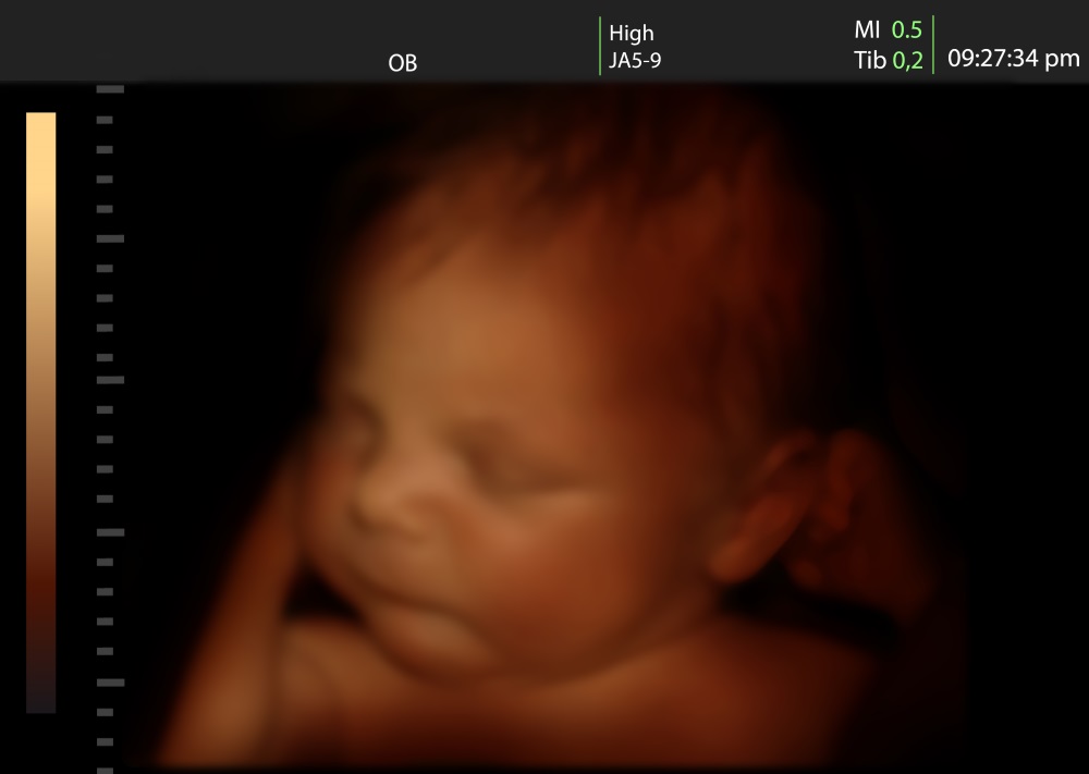 Image of newborn baby