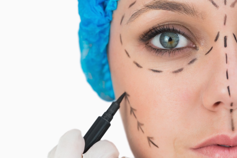Plastic surgeon marking face