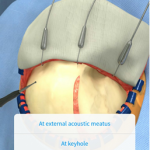 Touch surgery app