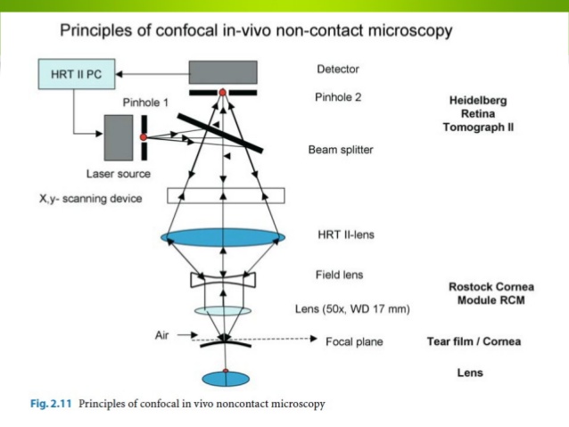 confocal microscopy of the eye