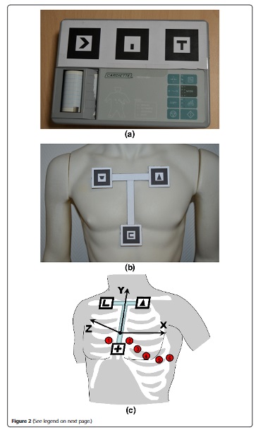 Portable ECG with markers