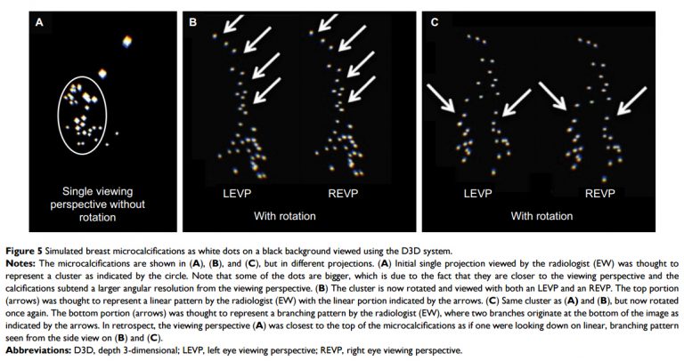 Augmented Reality for Mammography Assessment | Augmented Reality in ...